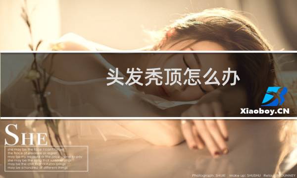 头发秃顶怎么办