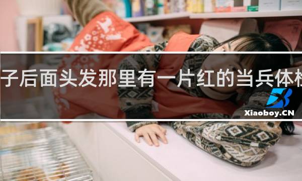 脖子后面头发那里有一片红的当兵体检能过吗