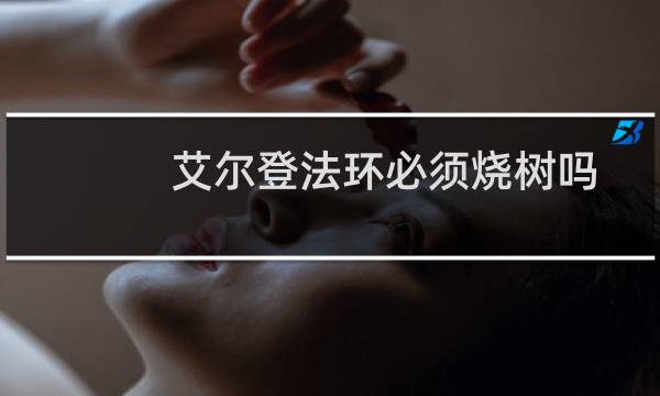 艾尔登法环必须烧树吗