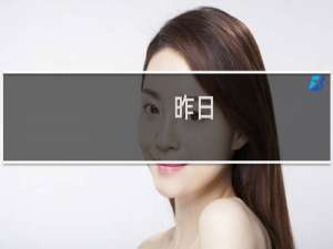 昨日 起源 攻略