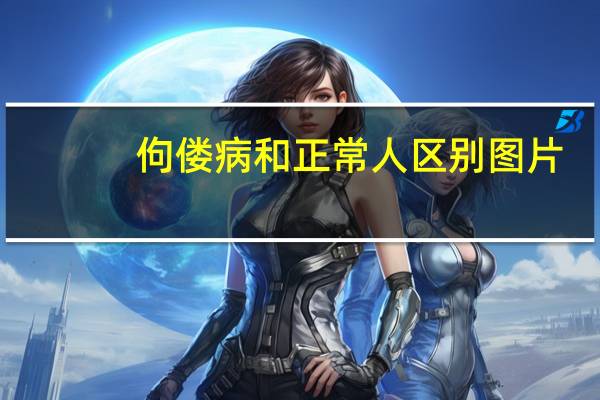 佝偻病和正常人区别图片（佝偻）