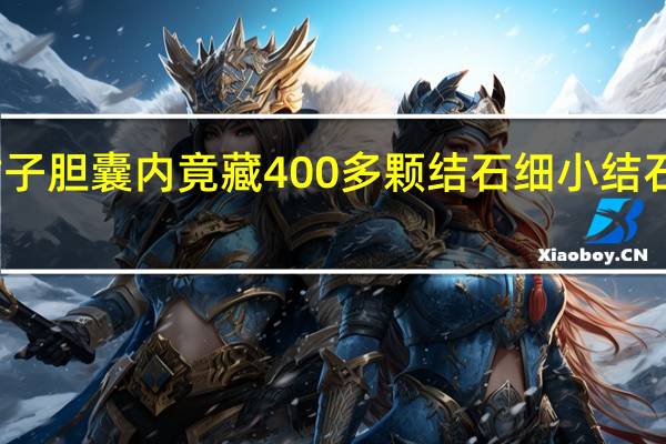 女子胆囊内竟藏400多颗结石 细小结石隐患大