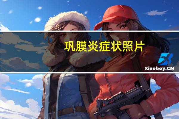 巩膜炎症状照片（巩膜炎症状）
