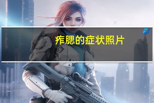 痄腮的症状照片（痄腮的症状）