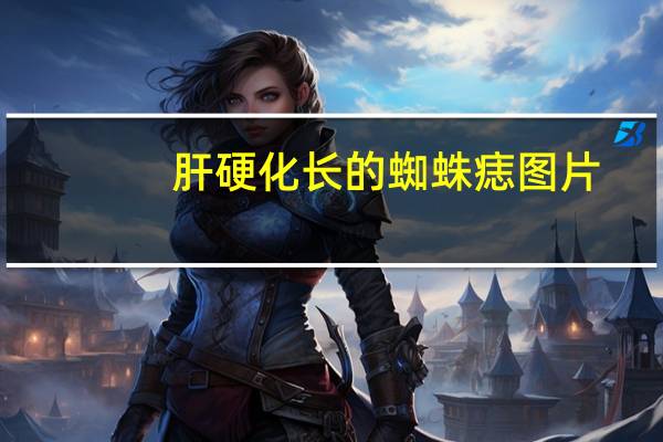 肝硬化长的蜘蛛痣图片（肝硬化蜘蛛痣图片）